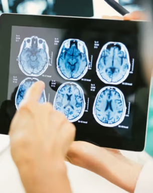Brain Tumor Surgery