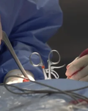 Minimally Invasive Spine Surgery