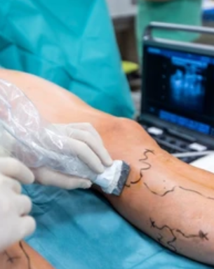 Neurovascular Surgery