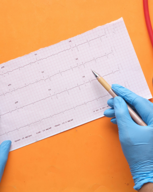 ECG