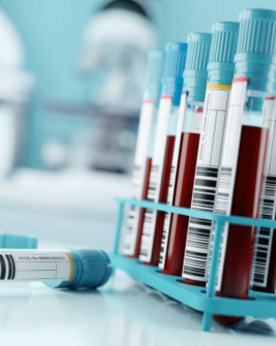 All Kind of Blood Tests
