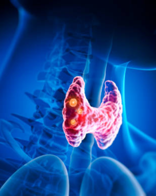 Thyroid & Parathyroid Disorders