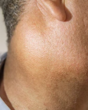 Neck & Salivary Gland Disorders