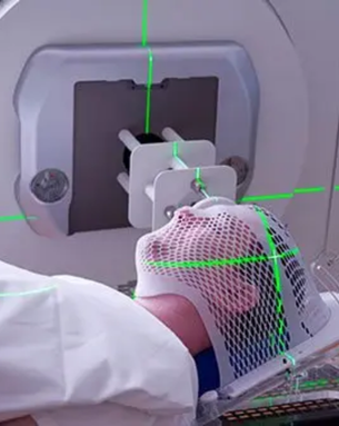 Stereotactic Radiation and Radiosurgery