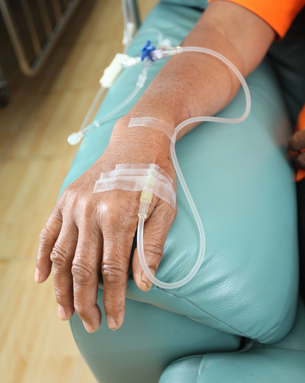 Chemotherapy