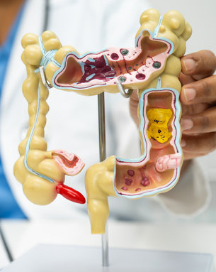 Gastrointestinal Diagnosis