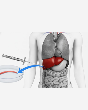Liver Biopsy