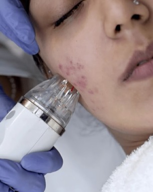 Advanced Treatments for Skin, Hair, and Nail Conditions