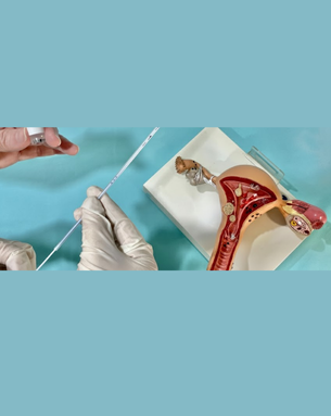 Cutting-edge fertility treatments and minimally invasive procedures designed to help you conceive with confidence