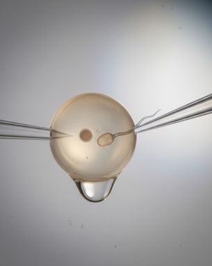 Cutting-edge fertility treatments and minimally invasive procedures designed to help you conceive with confidence