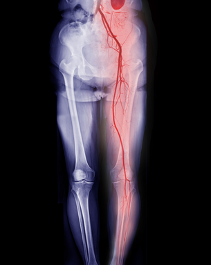 Complete Vascular Treatment Spectrum