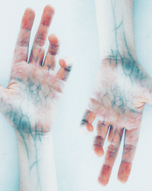 Complete Vascular Treatment Spectrum