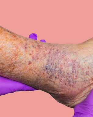 Complete Vascular Treatment Spectrum
