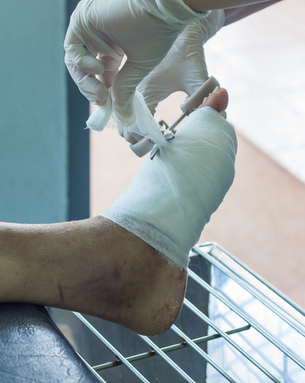 Complete Vascular Treatment Spectrum