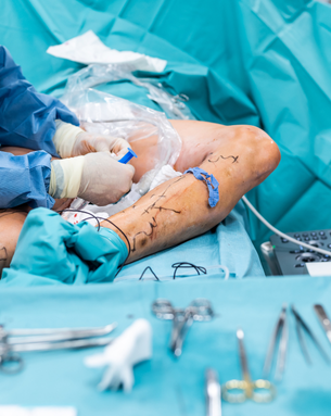 Complete Vascular Treatment Spectrum