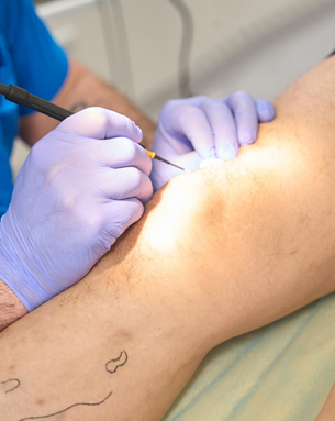 Complete Vascular Treatment Spectrum