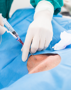 Complete Vascular Treatment Spectrum