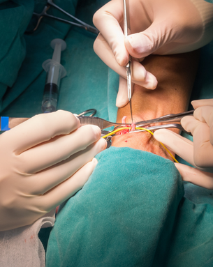 Complete Vascular Treatment Spectrum