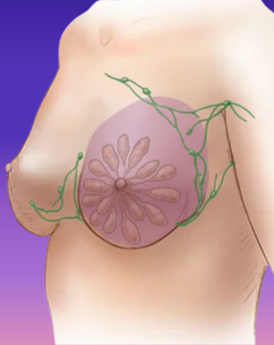 From Cure to Confidence – Complete Spectrum of Breast Surgery