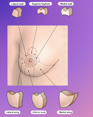 From Cure to Confidence – Complete Spectrum of Breast Surgery