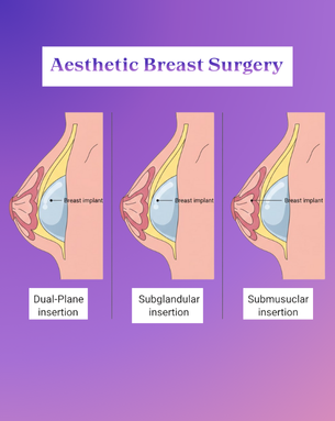 From Cure to Confidence – Complete Spectrum of Breast Surgery