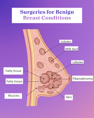 From Cure to Confidence – Complete Spectrum of Breast Surgery