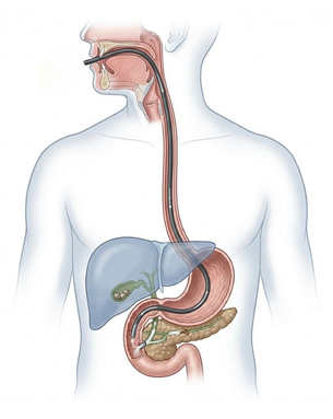 Complete gastrointestinal evaluation, treatment and endoscopic therapeutic solutions