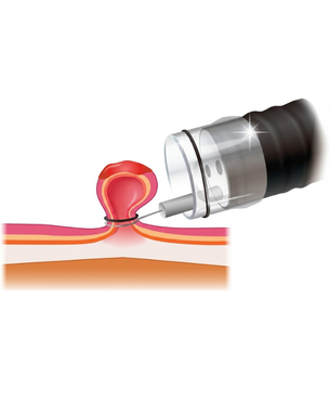 Complete gastrointestinal evaluation, treatment and endoscopic therapeutic solutions