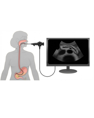 Complete gastrointestinal evaluation, treatment and endoscopic therapeutic solutions