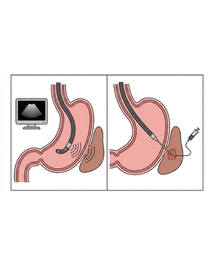 Complete gastrointestinal evaluation, treatment and endoscopic therapeutic solutions