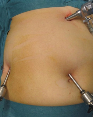 Comprehensive GI and Minimally Invasive Surgery