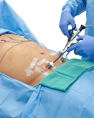Comprehensive GI and Minimally Invasive Surgery