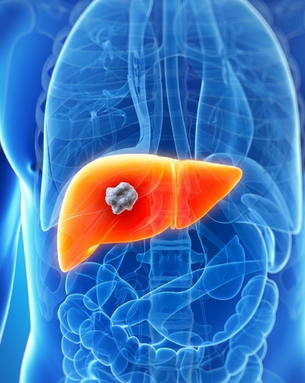 Comprehensive Care for Liver, Pancreas, Gallbladder, and Hepatobiliary Conditions