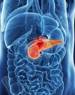 Comprehensive Care for Liver, Pancreas, Gallbladder, and Hepatobiliary Conditions