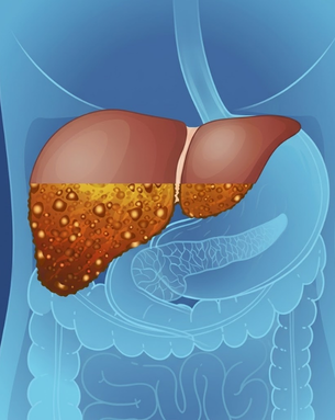 Comprehensive Care for Liver, Pancreas, Gallbladder, and Hepatobiliary Conditions