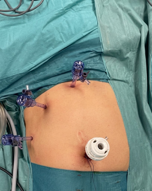 Comprehensive Care for Liver, Pancreas, Gallbladder, and Hepatobiliary Conditions