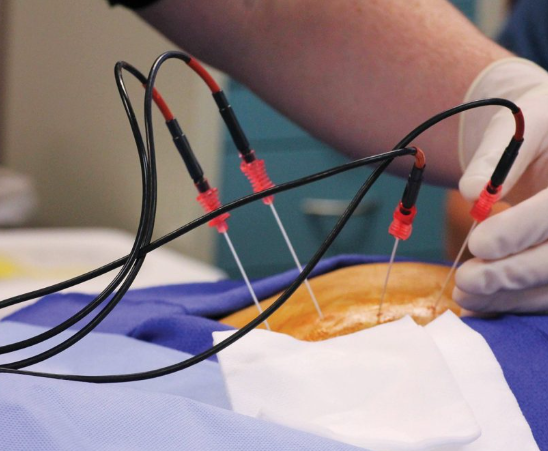 Expert Care Across Vascular & Endovascular Specialties