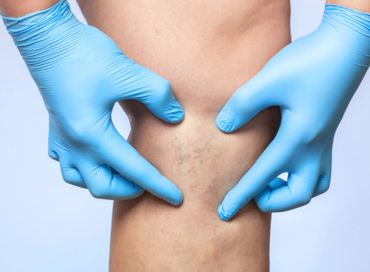 Expert Care Across Vascular & Endovascular Specialties