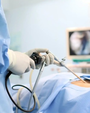 Laparoscopic Surgeries