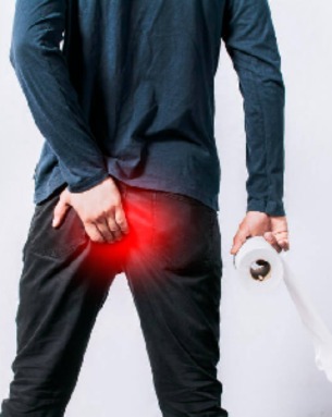 Stapled hemorrhoidopexy