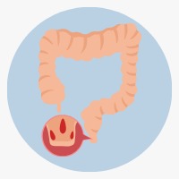 Anorectal surgeries